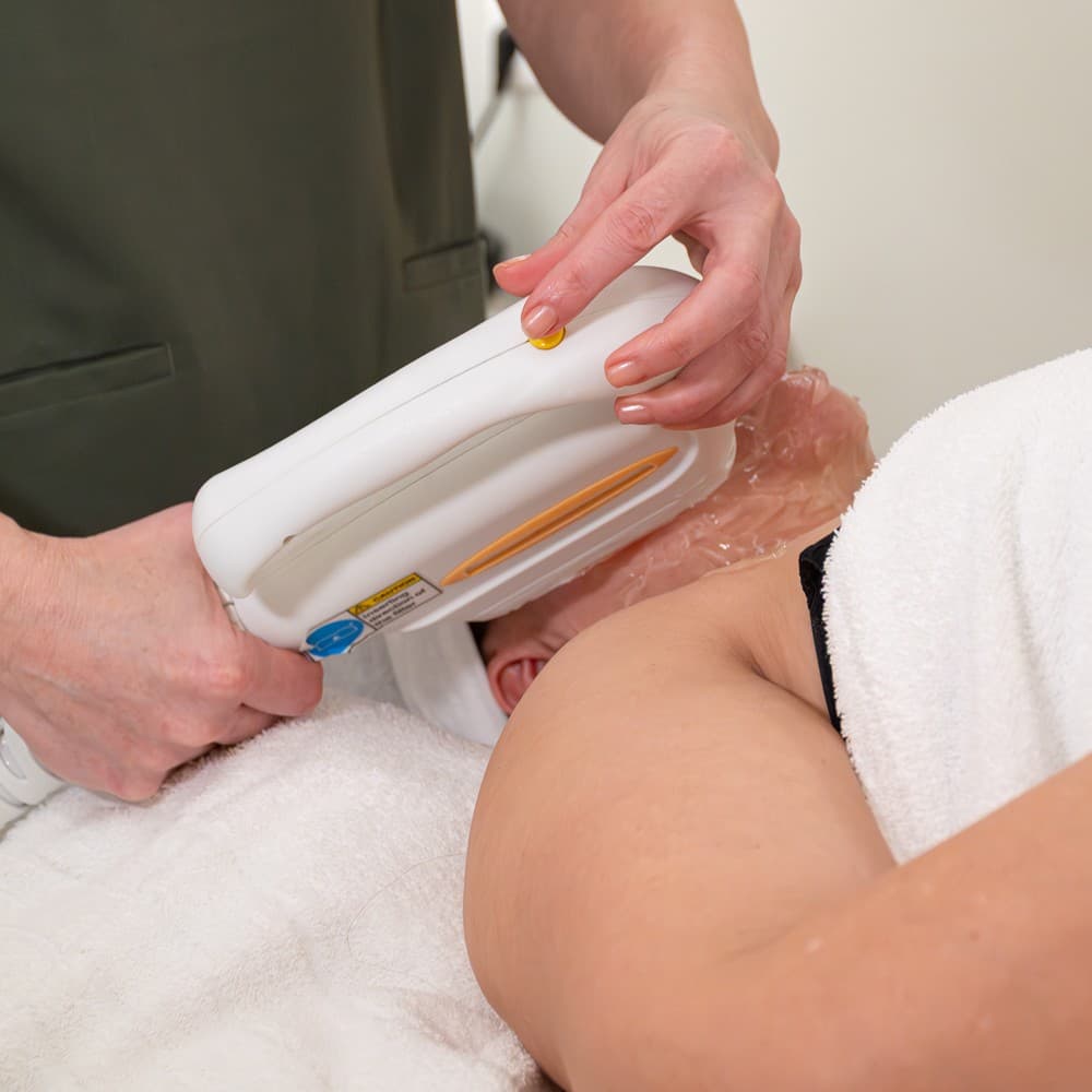 Fotorejuvenecimiento facial IPL